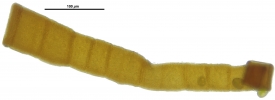 Tayloria splachnoides