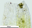 Cephaloziella spinigera