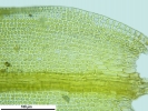 Schistidium confertum