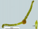Microbryum starckeanum