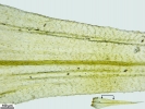 Breutelia chrysocoma