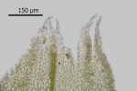 Lophozia silvicola