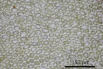 Lophozia silvicola