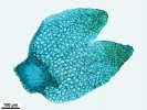 Gymnomitrion obtusum