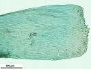 Isopterygiopsis muelleriana