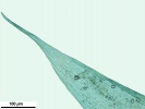 Isopterygiopsis muelleriana