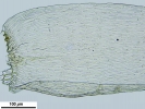 Isopterygiopsis muelleriana