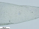 Isopterygiopsis muelleriana