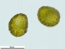 Ephemerum stoloniferum