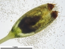 Cynodontium tenellum