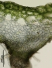 Asterella lindenbergiana