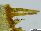 Encalypta affinis subsp. macounii