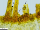 Encalypta affinis subsp. macounii