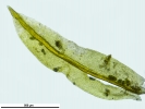 Zygodon stirtonii