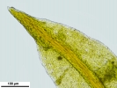 Zygodon stirtonii