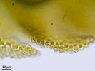 Acromastigum inaequilaterum