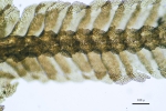 Acromastigum inaequilaterum
