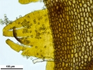 Tetraplodon angustatus