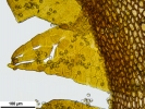 Tetraplodon angustatus