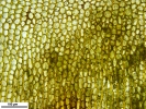 Tetraplodon angustatus