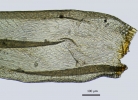 Meiothecium microcarpum