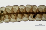 Ceratolejeunea belangeriana
