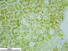 Cephaloziella integerrima