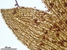 Cephaloziella integerrima