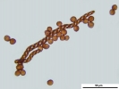 Cephaloziella integerrima