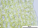 Cephaloziella integerrima