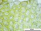 Cephaloziella integerrima