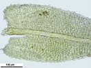 Claopodium whippleanum