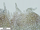 Lophozia ciliata