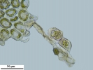 Lophozia ciliata