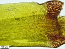 Campylopus atrovirens