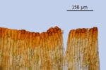 Encalypta pilifera