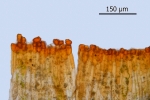 Encalypta pilifera