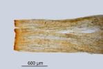 Encalypta pilifera