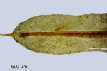 Encalypta pilifera
