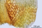 Dicranum spurium