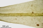 Dicranum spurium