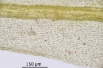 Dicranum spurium