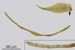 Dicranum spurium
