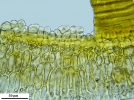 Grimmia triformis