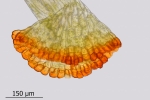 Encalypta pilifera