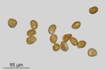 Encalypta pilifera