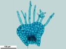 Harpalejeunea subacuta