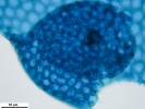 Harpalejeunea subacuta