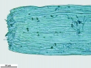 Lepyrodontopsis trichophylla
