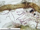 Isotachis erythrorhiza